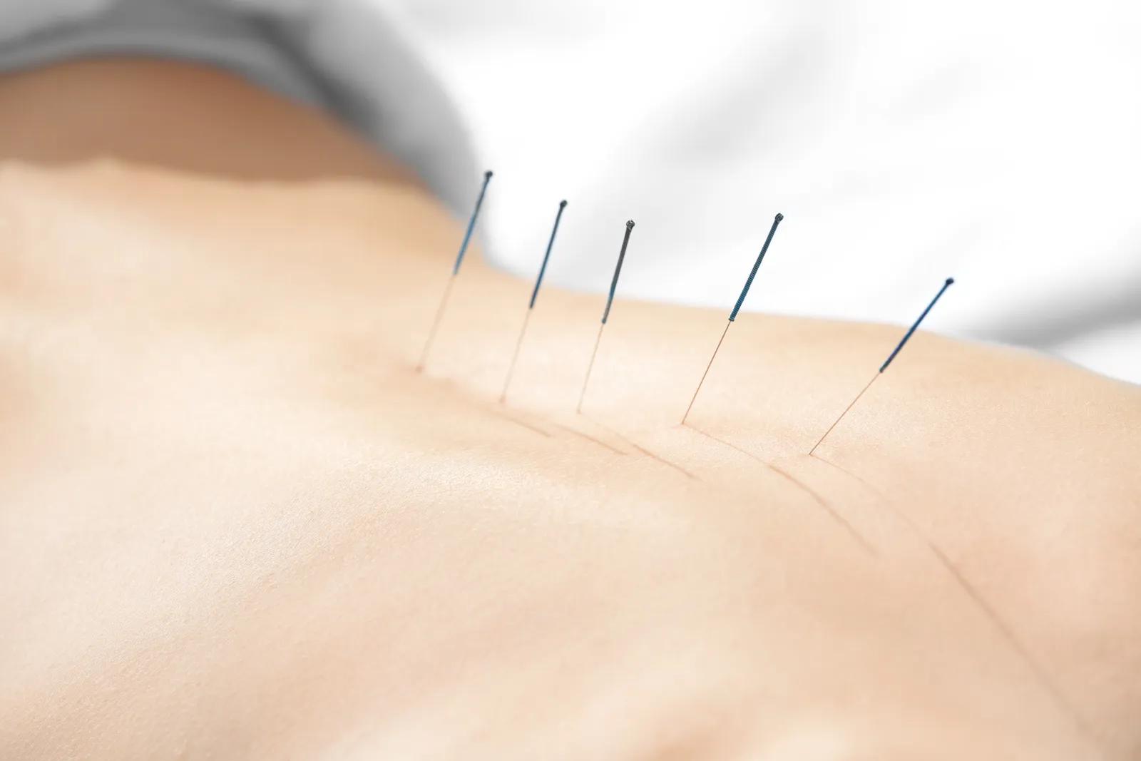 Acupressure Massage Therapy