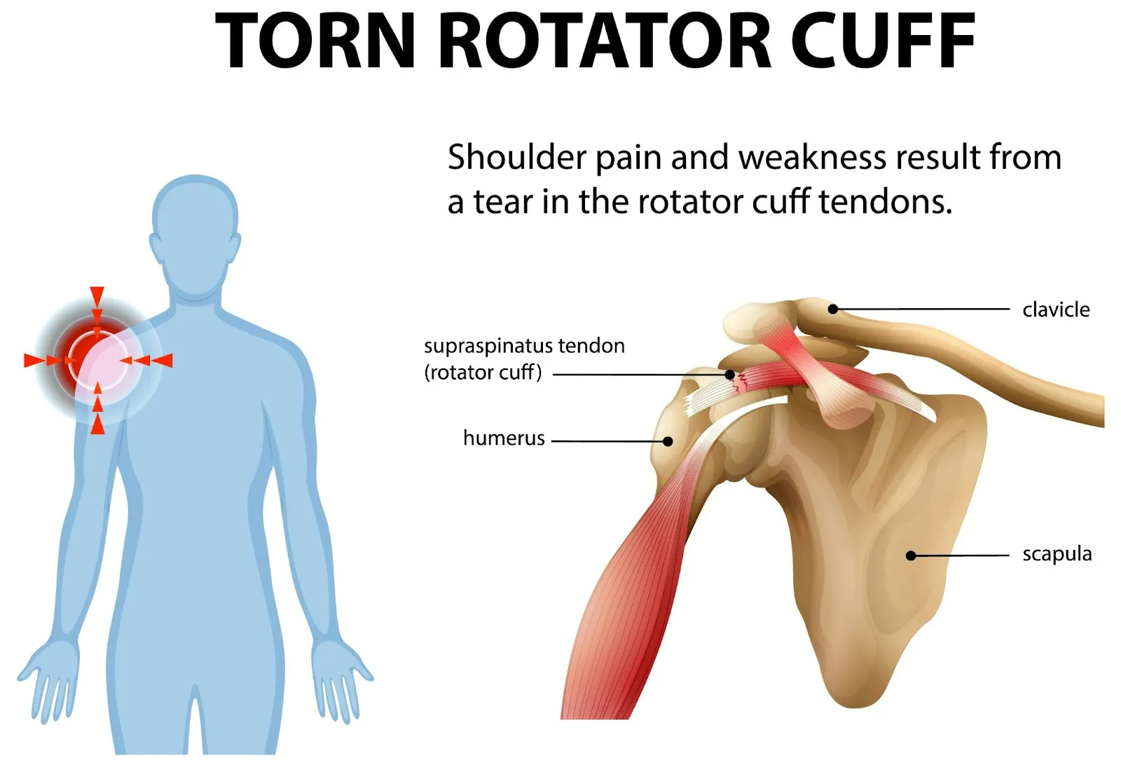 Say Goodbye to Arm Pain: How Chiropractic Care Can Help