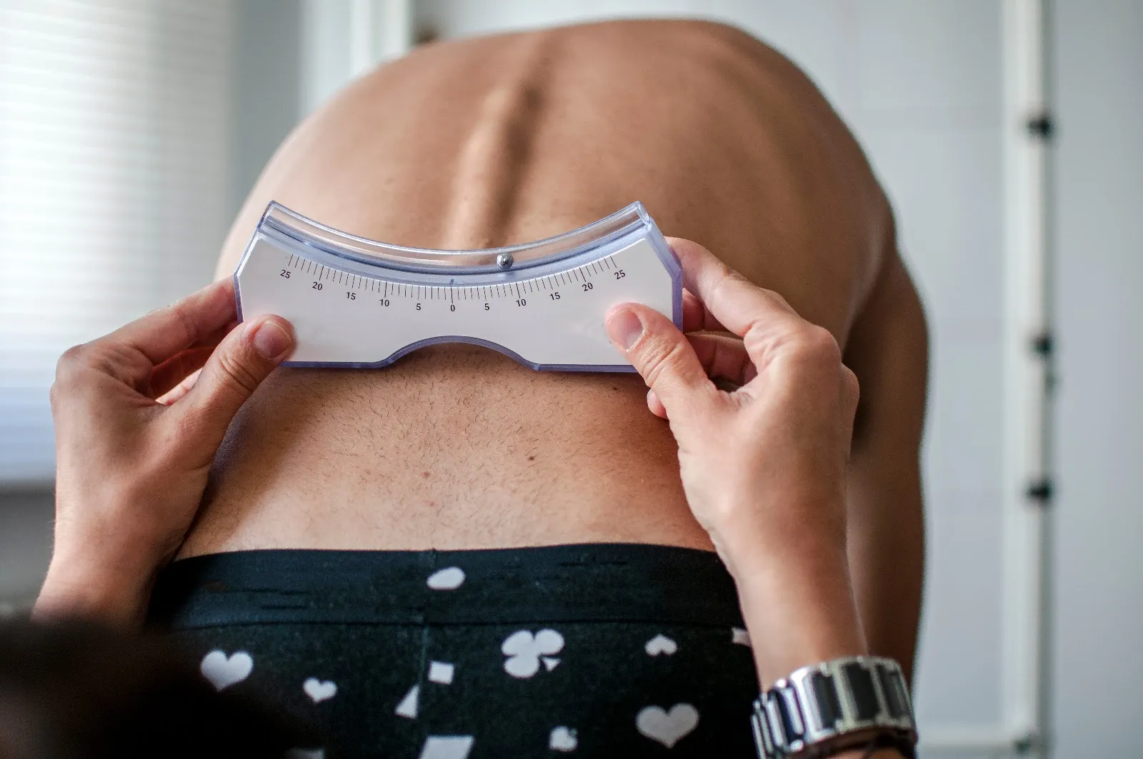 Scoliosis and Posture: Tips for Maintaining a Healthy Spine