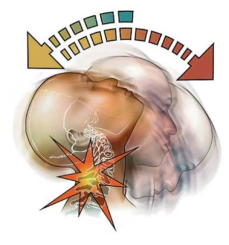 Understanding the Long-term Effects of Untreated Whiplash